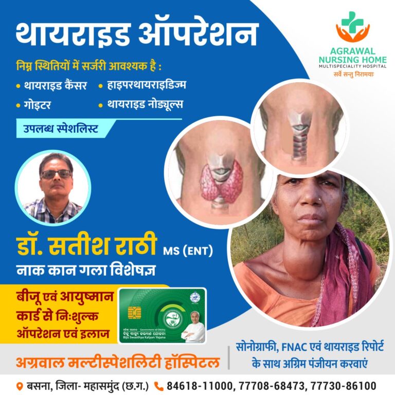 अग्रवाल नर्सिंग होम बसना में डॉ. सतीश राठी MS (ENT) नाक कान गला विशेषज्ञ बीजू एवं आयुष्मान कार्ड से निःशुल्क BE ऑपरेशन एवं इलाज