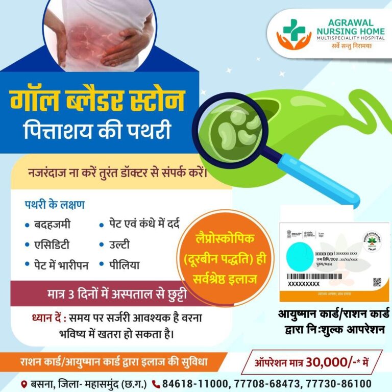 अग्रवाल नर्सिंग होम बसना में गॉल ब्लैडर स्टोन पित्ताशय की पथरी का होगा इलाज नजरंदाज ना करें तुरंत डॉक्टर से संपर्क करें।