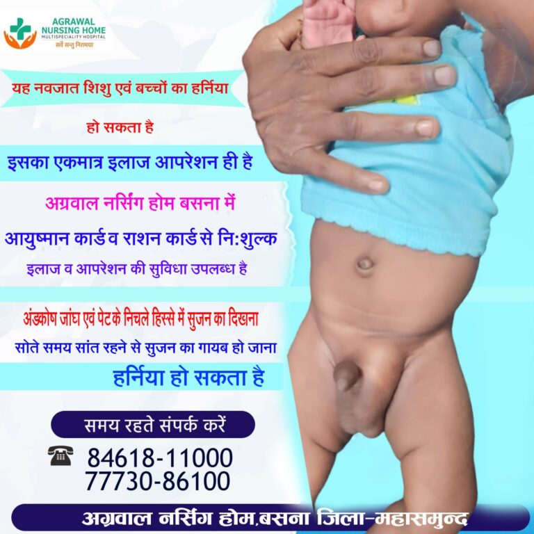 बसना -:नवजात शिशु एवं बच्चों का हर्निया हो सकता है इसका एकमात्र इलाज आपरेशन ही है अग्रवाल नर्सिंग होम बसना में