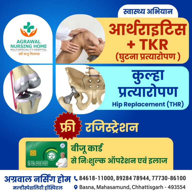 बसना : अग्रवाल नर्सिंग होम बसना में स्वास्थ्य अभियान आर्थराइटिस + TKR (घुटना प्रत्यारोपण) कुल्हा प्रत्यारोपण बीजू कार्ड से निःशुल्क ऑपरेशन एवं इलाज