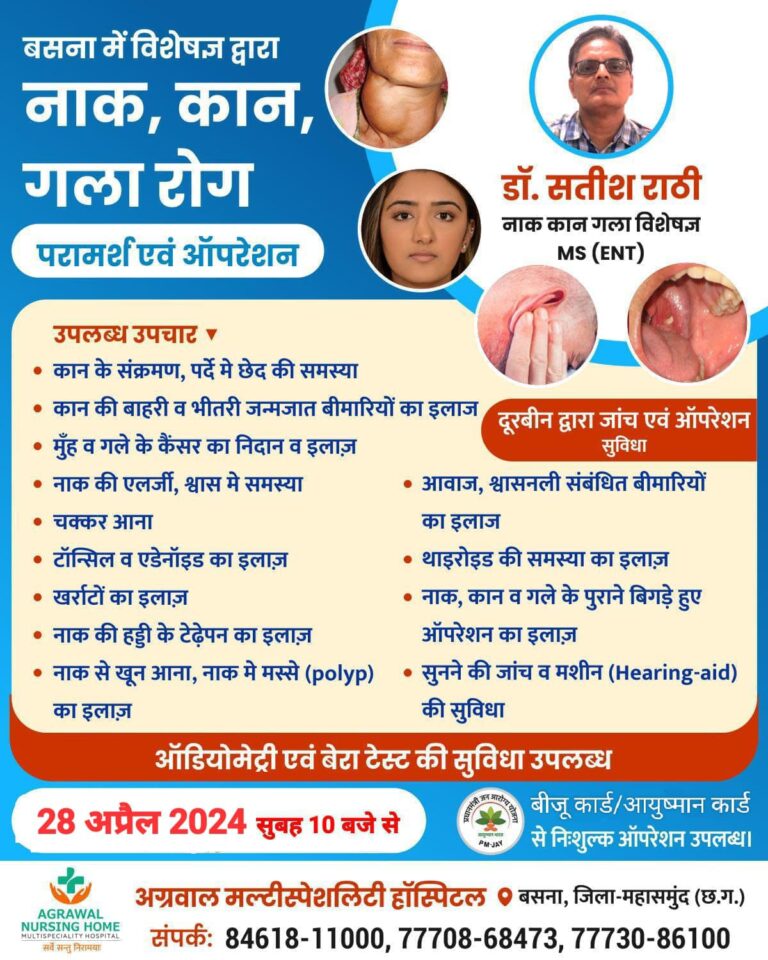 बसना में विशेषज्ञ द्वारा नाक, कान, गला रोग परामर्श एवं ऑपरेशन डॉ. सतीश राठी नाक कान गला विशेषज्ञ 28 अप्रैल 2024 सुबह 10 बजे से अग्रवाल नर्सिंग होम बसना मे