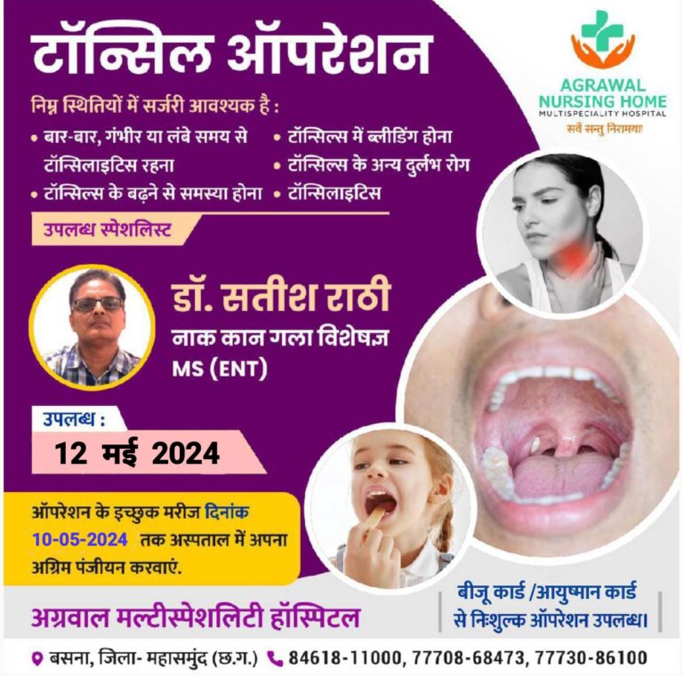 बसना : नाक कान गला विशेषज्ञ डॉ. सतीश राठी 12 मई 2024 को टॉन्सिल ऑपरेशन अग्रवाल नर्सिंग होम में