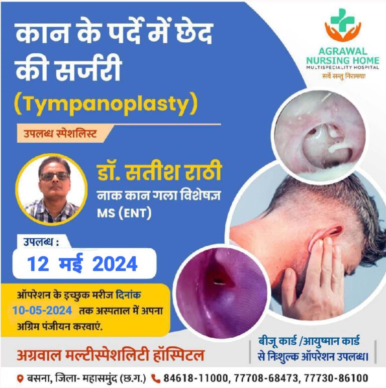 बसना : अग्रवाल नर्सिंग होम में कान के पर्दे में छेद की सर्जरी डॉ. सतीश राठी नाक कान गला विशेषज्ञ 12 मई 2024