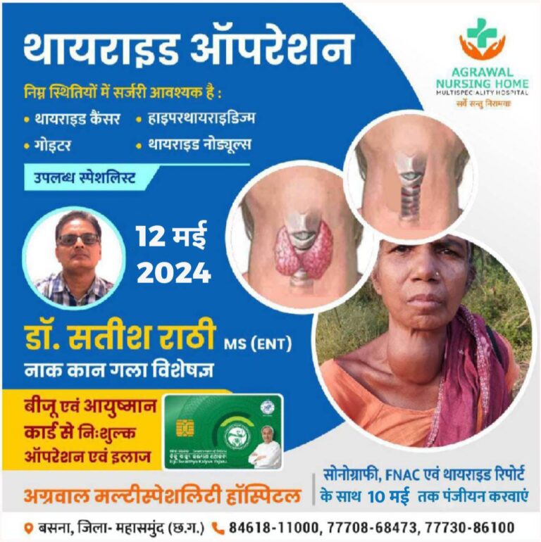 बसना : अग्रवाल नर्सिंग होम में थायराइड ऑपरेशन डॉ. सतीश राठी MS (ENT) नाक कान गला विशेषज्ञ 12 मई 2024