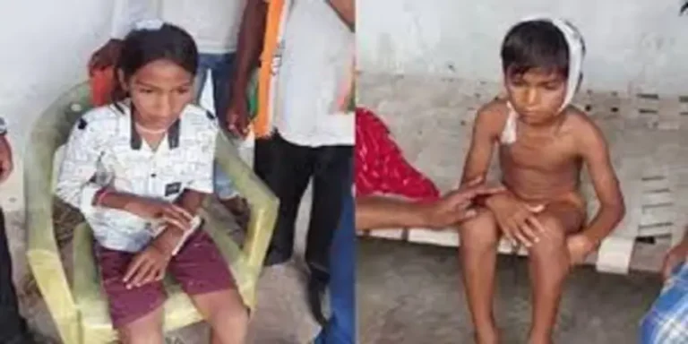 CG: स्कूल भवन की छत से गिरा प्लास्टर, छात्रा का सिर फटा, तो दूसरी घायल