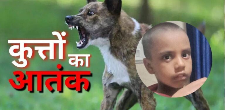 CG: थम नहीं रहा कुत्तों का आतंक… भिलाई में एक बच्ची को कई जगह नोचा