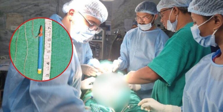 Cg News:जेल में बंद कैदी ने पेशाब नली में डाला 9cm लंबा पेंसिल, डॉक्टरों ने 3 घंटे के ऑपरेशन के बाद निकाला