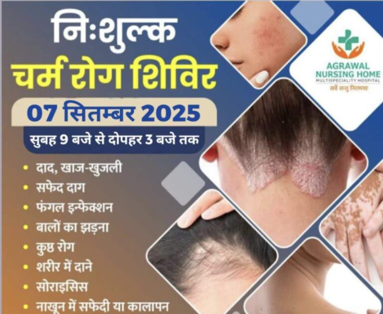 बसना : गुजरात से आएंगे वरिष्ठ स्किन स्पेशलिस्ट, बसना अग्रवाल नर्सिंग होम में मिलेगा निःशुल्क उपचार दाद, खाज, खुजली और सफेद दाग का इलाज – बसना में 7 सितम्बर को मुफ्त