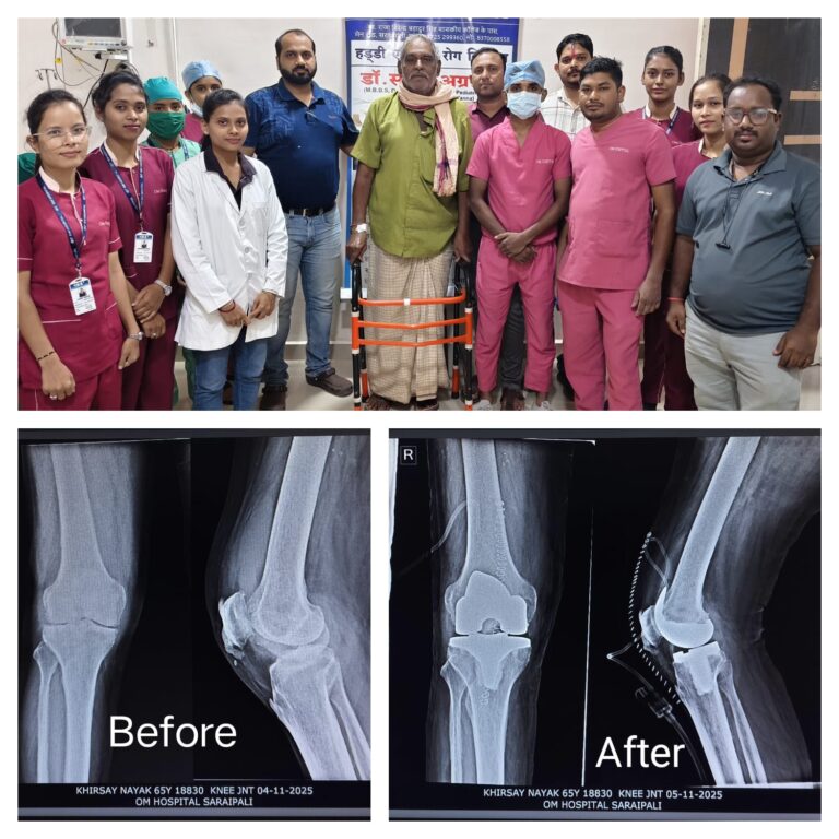ओम हॉस्पिटल, सरायपाली – रूमेटाइड आर्थराइटिस पर विजय की सच्ची कहानी